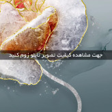 تابلو دکوراتیو ( 1509-MR ART )